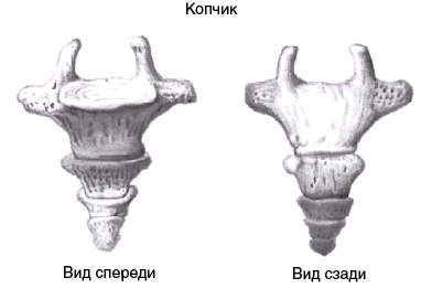 Bursitis coccyx